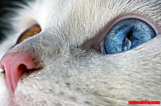 Heterochromia