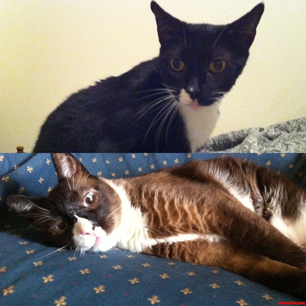 13 Year Old Half-siamese Twins