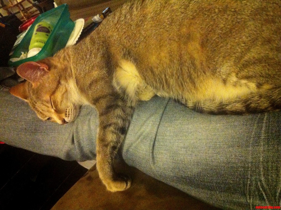 Looks Like Me and My Leg Are Staying in for the Night.