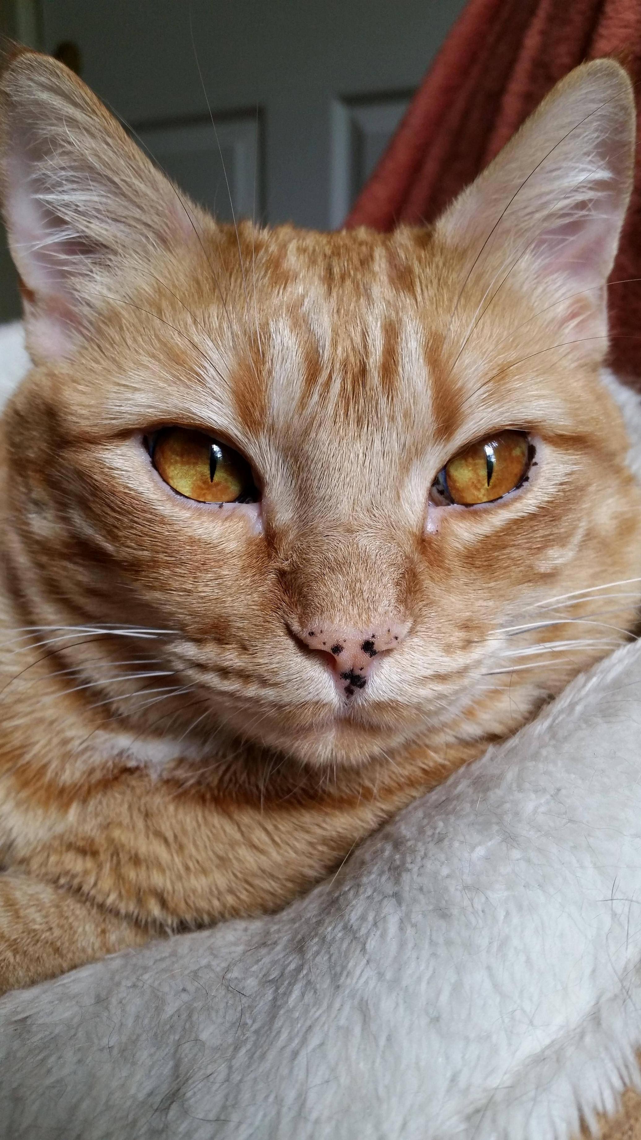 My Freckled Nose Girl