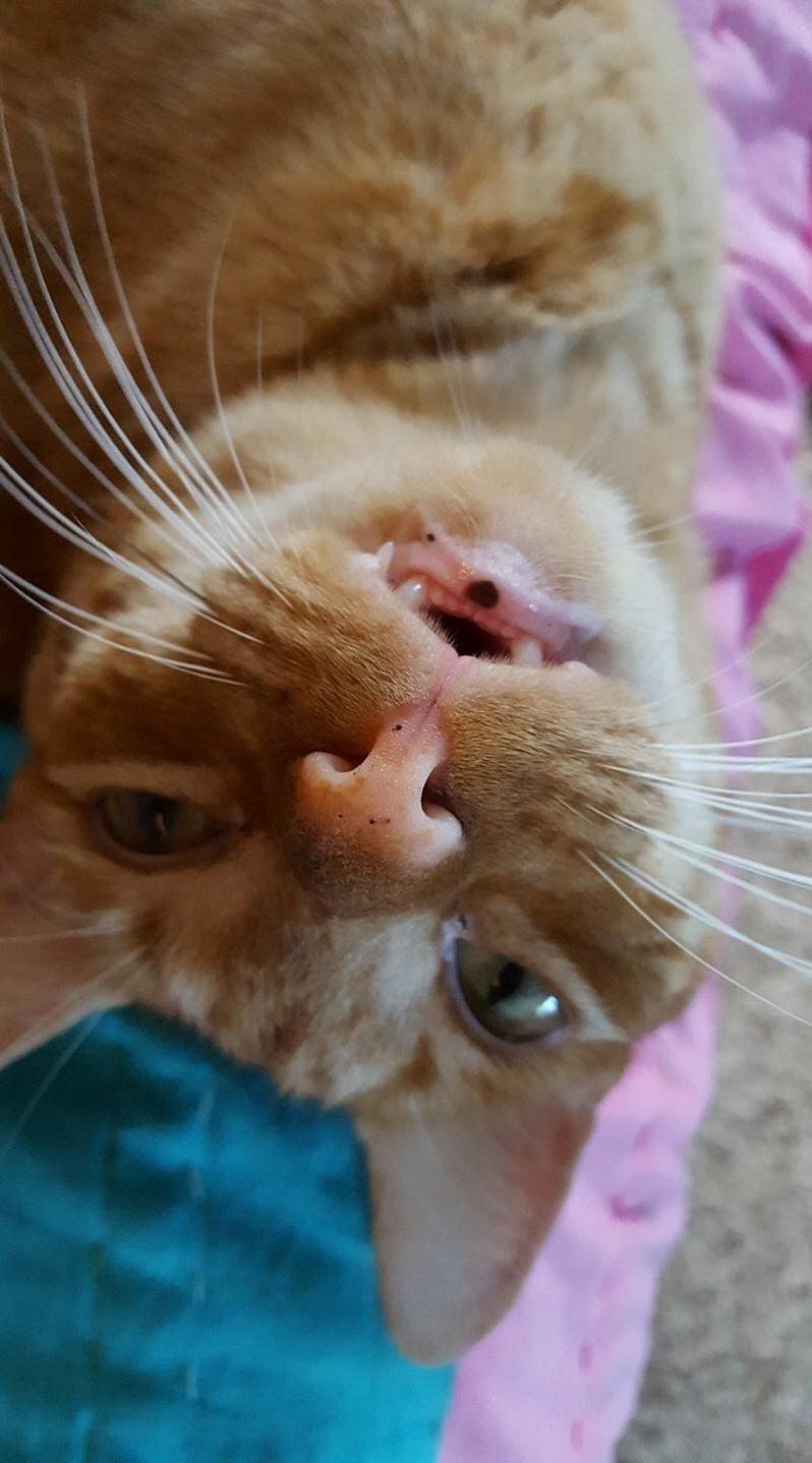 He Has a Little Heart Freckle
